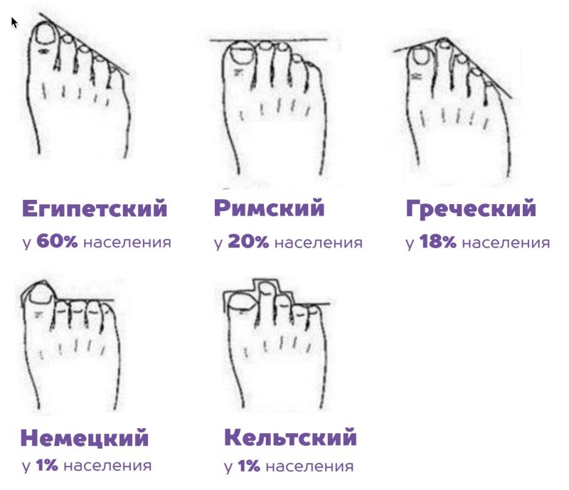 Типы стопы.jpg